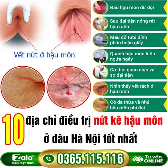 10 địa chỉ điều trị nứt kẽ hậu môn ở đâu Hà Nội tốt nhất