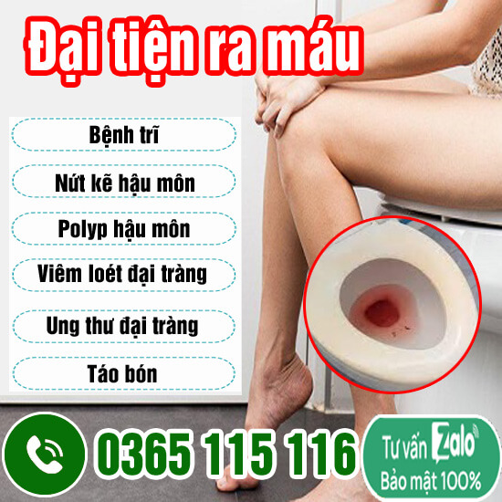 10 địa chỉ khám chữa đại tiện ra máu ở đâu Hà Nội tốt nhất