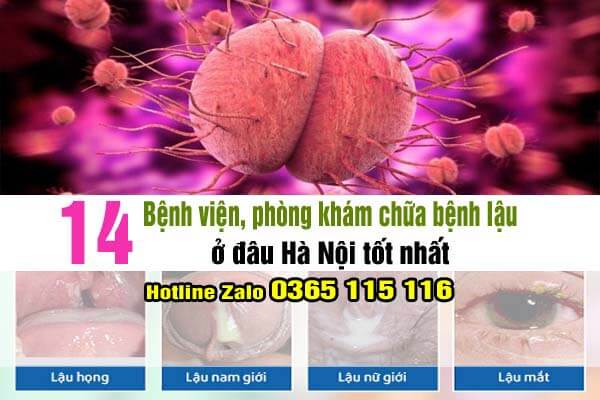 14 bệnh viện, phòng khám chữa bệnh lậu ở đâu Hà Nội tốt nhất