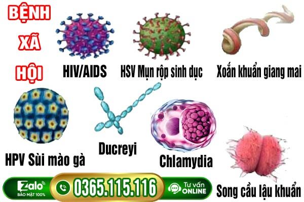 Các bệnh xã hội nguy hiểm thường gặp và dấu hiệu ở nam nữ