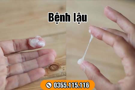 8 bệnh xã hội thường gặp nguy hiểm và dấu hiệu nhận biết