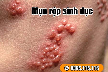 8 bệnh xã hội thường gặp nguy hiểm và dấu hiệu nhận biết