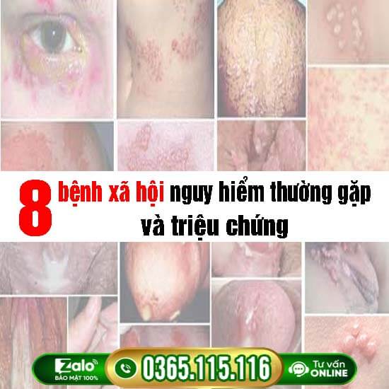8 bệnh xã hội thường gặp nguy hiểm và dấu hiệu nhận biết