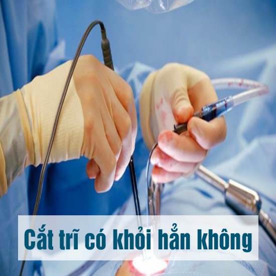 Cắt trĩ có khỏi hẳn không, sau cắt trĩ có tái phát không?