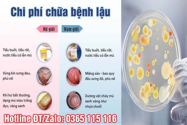 Chi Phí Điều Trị Bệnh Lậu: Tất Tần Tật Những Điều Bạn Cần Biết