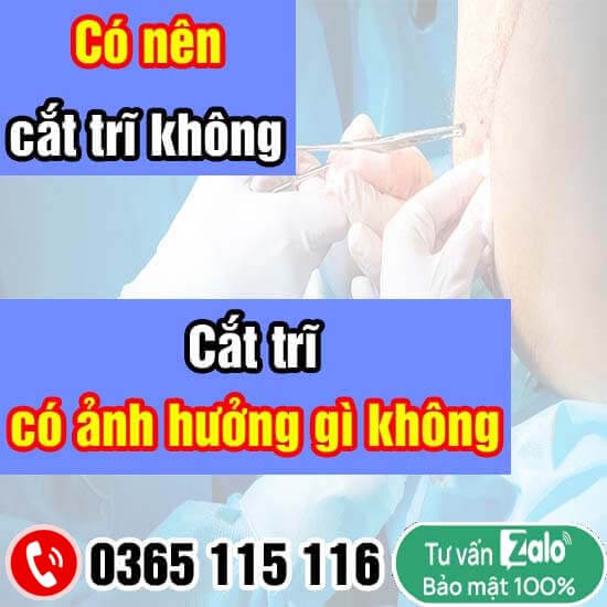 Có nên cắt trĩ không, cắt trĩ có ảnh hưởng gì không?