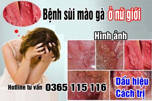 Bệnh sùi mào gà ở nữ giới: Hình ảnh, dấu hiệu, cách trị