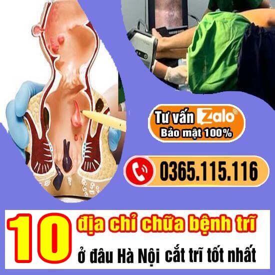 10 bệnh viện, phòng khám chữa bệnh trĩ ở đâu tốt nhất Hà Nội