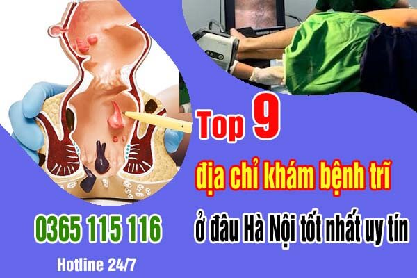 Top 9 địa chỉ khám bệnh trĩ ở đâu Hà Nội tốt nhất uy tín